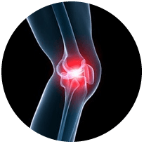 trattamento mal di schiena